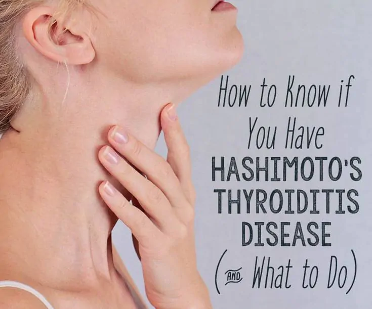 How to Know If You Have Hashimoto_s Disease